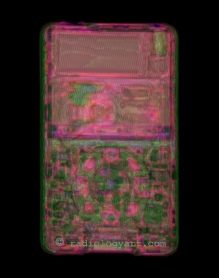 Illustration for article titled CT Scans of iPhone: Safer Than Exploratory Surgery